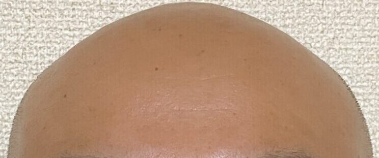 「Win your Life with Winx3! 3つのWinで前向きマインドを手に入れ、楽しく明るい未来を実現しよう！」